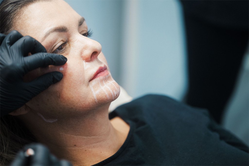 Dr Lauren teaching her students how to map out where to inject fillers in a patient's face.